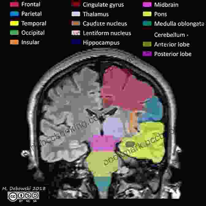 Brain Scan Of The Cerebrum The Bomb Inside My Brain